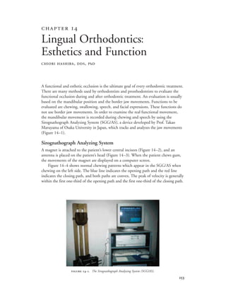 
A functional and esthetic occlusion is the ultimate goal of every orthodontic treatment.
There are many methods used by orthodontists and prosthodontists to evaluate the
functional occlusion during and after orthodontic treatment. An evaluation is usually
based on the mandibular position and the border jaw movements. Functions to be
evaluated are chewing, swallowing, speech, and facial expressions. These functions do
not use border jaw movements. In order to examine the real functional movement,
the mandibular movement is recorded during chewing and speech by using the
Sirognathograph Analyzing System (SGG/AS), a device developed by Prof. Takao
Maruyama of Osaka University in Japan, which tracks and analyzes the jaw movements
(Figure 14–1).
Sirognathograph Analyzing System
A magnet is attached to the patient’s lower central incisors (Figure 14–2), and an
antenna is placed on the patient’s head (Figure 14–3). When the patient chews gum,
the movements of the magnet are displayed on a computer screen.
Figure 14–4 shows normal chewing patterns which appear in the SGG/AS when
chewing on the left side. The blue line indicates the opening path and the red line
indicates the closing path, and both paths are convex. The peak of velocity is generally
within the first one-third of the opening path and the first one-third of the closing path.
 
Lingual Orthodontics:
Esthetics and Function
CHIORI HASHIBA, DDS, PhD
 -. The Sirognathograph Analyzing System (SGG/AS).
 
