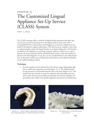 
The CLASS technique offers a method of lingual bracket placement that takes into
account the anatomical discrepancies in the lingual surfaces of the teeth. This is
accomplished by first constructing an ideal diagnostic set-up from a duplicate set-up
model of the patient’s original malocclusion. This ideal set-up or template is then used
as a physical guide to place the lingual brackets in an ideal configuration. The brackets
are placed on the diagnostic set-up using composite adhesive, which acts as a spacer
between the metal mesh pad and the individual dental surfaces. After the brackets are
placed on the ideal diagnostic set-up, they are next transferred back to the malocclusion
cast. At this point, transfer trays are fabricated so the brackets can be delivered clinically
via the indirect bonding method.
Technique
1. Accurate models must be obtained from the patient using a high quality algi-
nate or rubber base impression material (Figure 15–1). The models should
next be poured in a hard model material such as die stone (Figure 15–2). The
models must be extremely accurate for optimum clinical bonding and treat-
ment results. Once accurate models are obtained, the clinician completes the
prescription sheet which is the specific diagnostic instructions to the laboratory
 
The Customized Lingual
Appliance Set-Up Service
(CLASS) System
SCOTT A. HUGE
 -. Accurate models are obtained from the patient
using a high quality alginate or rubber based impression material.
 -. The models poured in a hard model material
such as die stone.
 