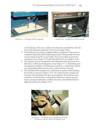 The Customized Lingual Appliance Set-Up Service (CLASS) System 
to the laboratory. The more complete the information provided from the clin-
ician to the laboratory technician, the better the results will be.
2. In the laboratory, the doctor’s original models are duplicated. This process is
completed using hydrocolloid duplicating material, which provides the most
accurate duplicate for the set-up models. The set-up models are poured in
orthodontic stone (Figure 15–5) and then dried in the oven (Figure 15–6).
3. The duplicate casts are identified by each individual tooth and sectioned, as
illustrated, to fabricate the diagnostic set-up (Figure 15–7). Depending upon
the equipment available to the laboratory technician, a combination of hand
saws and grinding wheels can be used to section and trim the teeth.
4. The individual teeth are placed on a preformed set-up base which facilitates
the overall set-up process (Figure 15–8). The technician then arranges and
resets the teeth according to the doctor’s prescription. The technician must
coordinate overall arch form, occlusal plane dimensions, anterior tip and
torque, spacing considerations, overbite and overjet, and individual dental
alignment and rotation (Figure 15–9).
 -. The original models are duplicated.
 -. The duplicate casts are identified by each individ-
ual tooth and sectioned to fabricate the diagnostic set-up.
 -. The duplicates are dried in the oven.
 