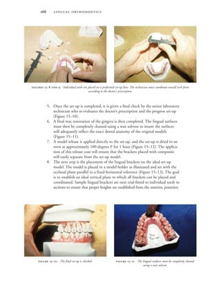  
5. Once the set-up is completed, it is given a final check by the senior laboratory
technician who re-evaluates the doctor’s prescription and the progress set-up
(Figure 15–10).
6. A final wax restoration of the gingiva is then completed. The lingual surfaces
must then be completely cleaned using a wax solvent to insure the surfaces
will adequately reflect the exact dental anatomy of the original models
(Figure 15–11).
7. A model release is applied directly to the set-up, and the set-up is dried in an
oven at approximately 100 degrees F for 1 hour (Figure 15–12). The applica-
tion of this release coat will ensure that the brackets placed with composite
will easily separate from the set-up model.
8. The next step is the placement of the lingual brackets on the ideal set-up
model. The model is placed in a model holder as illustrated and set with the
occlusal plane parallel to a fixed horizontal reference (Figure 15–13). The goal
is to establish an ideal vertical plane to which all brackets can be placed and
coordinated. Sample lingual brackets are next trial-fitted to individual teeth in
sections to ensure that proper heights are established from the anterior, posterior,
 -. The final set-up is checked.  -. The lingual surfaces must be completely cleaned
using a wax solvent.
 -  . Individual teeth are placed on a preformed set-up base. The technician must coordinate overall arch form
according to the doctor’s prescription.
 