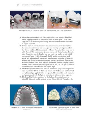  
14. The malocclusion models with the transferred brackets are next placed back
on the copying machine for a second occlusal record (Figure 15–28). This
copy will act as the initial guide to help the clinician fabricate the first series
of lingual archwires.
15. Transfer trays are now made on the malocclusion cast. At the present time
the recommended transfer tray technique is a two-tray system processed on
the Biostar machine. The inner tray is a 1.5 mm Bioplast and the outer tray is
a 1.0 Biocryl. This combination gives the best overall clinical results. The clin-
ician should first seat the Bioplast tray and bend it as needed to gain initial
placement (Figure 15–29). Once each flexible section is seated, the hard
acrylic tray is immediately placed over it and pressure is applied to bring the
adhesive and dental surfaces into complete contact. In addition, the trays are
sectioned in two or three pieces per arch to allow the clinician complete control
over the clinical bonding process (Figures 15–30 and 31). The specific fabrica-
tion technique is detailed in the next several steps.
16. The first step in tray fabrication is model preparation. Any deep interproximal
areas or potential defects in the model must be blocked out. An ideal material
is a light-cured gel applied with a wax spatula. This material is easily moldable
and quickly cured with the light to minimize the laboratory time required.
17. The lingual ball hooks must then be blocked out. In this technique, an
injectable silicone is used in a plastic syringe (Figure 15–32). This allows the
 -  . Brackets are secured to the malocclusion model using a water soluble adhesive.
 -. The clinician can bend the Bioplast tray as
needed to gain initial placement.
 -. A copying machine is used to make a second
occlusal record.
 
