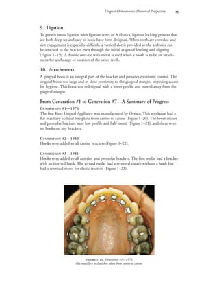 Lingual Orthodontics: Historical Perspective 
9. Ligation
To permit stable ligation with ligature wires or A elastics, ligature locking grooves that
are both deep set and easy to hook have been designed. When teeth are crowded and
slot engagement is especially difficult, a vertical slot is provided so the archwire can
be attached to the bracket even through the initial stages of leveling and aligning
(Figure 1–19). A double over-tie with metal is used when a tooth is to be an attach-
ment for anchorage or rotation of the other teeth.
10. Attachments
A gingival hook is an integral part of the bracket and provides rotational control. The
original hook was large and in close proximity to the gingival margin, impeding access
for hygiene. This hook was redesigned with a lower profile and moved away from the
gingival margin.
From Generation #1 to Generation #7—A Summary of Progress
GENERATION #1—1976
The first Kurz Lingual Appliance was manufactured by Ormco. This appliance had a
flat maxillary occlusal bite plane from canine to canine (Figure 1–20). The lower incisor
and premolar brackets were low profile and half-round (Figure 1–21), and there were
no hooks on any brackets.
GENERATION #2—1980
Hooks were added to all canine brackets (Figure 1–22).
GENERATION #3—1981
Hooks were added to all anterior and premolar brackets. The first molar had a bracket
with an internal hook. The second molar had a terminal sheath without a hook but
had a terminal recess for elastic traction (Figure 1–23).
 -. Generation #1—1976.
Flat maxillary occlusal bite plane from canine to canine.
 