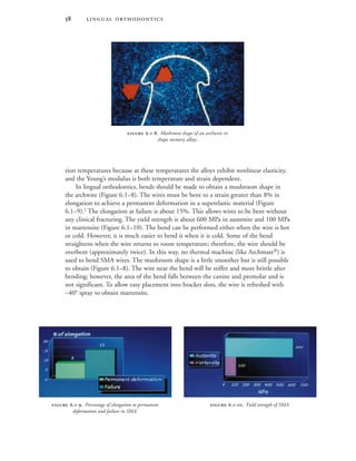  
tion temperatures because at these temperatures the alloys exhibit nonlinear elasticity,
and the Young’s modulus is both temperature and strain dependent.
In lingual orthodontics, bends should be made to obtain a mushroom shape in
the archwire (Figure 6.1–8). The wires must be bent to a strain greater than 8% in
elongation to achieve a permanent deformation in a superelastic material (Figure
6.1–9).2
The elongation at failure is about 15%. This allows wires to be bent without
any clinical fracturing. The yield strength is about 600 MPa in austenite and 100 MPa
in martensite (Figure 6.1–10). The bend can be performed either when the wire is hot
or cold. However, it is much easier to bend it when it is cold. Some of the bend
straightens when the wire returns to room temperature; therefore, the wire should be
overbent (approximately twice). In this way, no thermal machine (like Archmate®
) is
used to bend SMA wires. The mushroom shape is a little smoother but is still possible
to obtain (Figure 6.1–8). The wire near the bend will be stiffer and more brittle after
bending; however, the area of the bend falls between the canine and premolar and is
not significant. To allow easy placement into bracket slots, the wire is refreshed with
–40° spray to obtain martensite.
 .-. Yield strength of SMA. .-. Percentage of elongation to permanent
deformation and failure in SMA.
 .-. Mushroom shape of an archwire in
shape memory alloys.
 