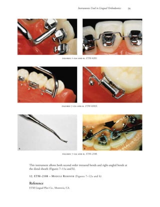 Instruments Used in Lingual Orthodontics 
 -  . ETM–8201.
 
 -  . ETM–8202L.
 
 -  . ETM–2108.
 
This instrument allows both second order intraoral bends and right-angled bends at
the distal sheath (Figures 7–11a and b).
12. ETM–2108 – MODULE REMOVER (Figures 7–12a and b)
Reference
ETM Lingual Plier Co., Monrovia, CA.
 