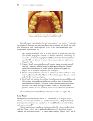  
Although enamel reproximation has had both negative3,4
and positive5–7
reviews in
the orthodontic literature, it remains an effective way to increase arch length and maxi-
mize the cosmetic result. Some important factors to take into consideration when
doing enamel reproximation are:
1. Age: Younger patients are likely to be more sensitive to enamel reduction than
older patients. Large pulp chambers and dentinal tubules are contributing fac-
tors to this sensitivity. Radiographs should be evaluated to determine adequate
enamel width and dentinal proximity before enamel reduction is performed
(Figure 9.1–6).
2. Hygiene: Rough interproximal areas will increase plaque accumulation and,
therefore, caries susceptibility in patients with poor oral hygiene. Enamel
reproximation should only be used in patients demonstrating good oral
hygiene and in areas with adequate access for hygiene.
3. Enamel sensitivity: Enamel reduction in patients with a low threshold of sensi-
tivity may be uncomfortable. The use of desensitizing agents should be consid-
ered with this patient population.
4. Size of teeth and amount of crowding: Enamel reproximation should be avoid-
ed in patients with small teeth and severe crowding. Also, the shape of the
tooth should be considered. Triangular crowns are more amenable to enamel
reduction than narrow, rectangular crowns. Presence of porcelain crowns,
porcelain veneers, and root proximity should also be taken into consideration.
The enamel reproximation technique is described in detail in Chapter 9.3.
Case Report
The following case demonstrates the use of a combination of techniques used to
achieve a non-extraction treatment in a crowded malocclusion. A 35-year-old female
patient presented with the chief complaint of “I would like a broader smile and my
teeth are too crowded.”
Clinical examination revealed a mesognathic profile with a narrow and restricted
smile line (Figures 9.1–7a and b), a Class I malocclusion with 4 to 5 mm of upper
crowding and moderate-to-severe (7 to 9 mm) lower crowding (Figures 9.1–7c and d).
 .-. Occlusal view of modified Crozat appliance. Lingual
anterior sweeps are added only if incisor proclination is desired.
 