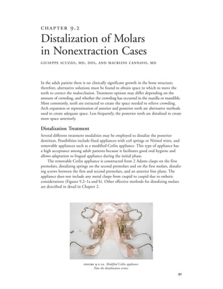 
In the adult patient there is no clinically significant growth in the bone structure;
therefore, alternative solutions must be found to obtain space in which to move the
teeth to correct the malocclusion. Treatment options may differ depending on the
amount of crowding, and whether the crowding has occurred in the maxilla or mandible.
Most commonly, teeth are extracted to create the space needed to relieve crowding.
Arch expansion or reproximation of anterior and posterior teeth are alternative methods
used to create adequate space. Less frequently, the posterior teeth are distalized to create
more space anteriorly.
Distalization Treatment
Several different treatment modalities may be employed to distalize the posterior
dentition. Possibilities include fixed appliances with coil springs or Nitinol wires, and
removable appliances such as a modified Cetlin appliance. This type of appliance has
a high acceptance among adult patients because it facilitates good oral hygiene and
allows adaptation to lingual appliance during the initial phase.
The removable Cetlin appliance is constructed from 2 Adams clasps on the first
premolars, distalizing springs on the second premolars and on the first molars, distaliz-
ing screws between the first and second premolars, and an anterior bite plane. The
appliance does not include any metal clasps from cuspid to cuspid due to esthetic
considerations (Figures 9.2–1a and b). Other effective methods for distalizing molars
are described in detail in Chapter 2.
 .
Distalization of Molars
in Nonextraction Cases
GIUSEPPE SCUZZO, MD, DDS, AND MAURIZIO CANNAVO, MD
 .-. Modified Cetlin appliance.
Note the distalization screws.
 
