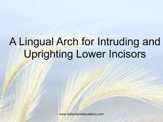 A Lingual Arch for Intruding and
Uprighting Lower Incisors
www.indiandentalacademy.com
 