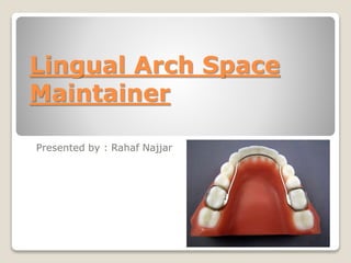 Lingual Arch Space
Maintainer
Presented by : Rahaf Najjar
 