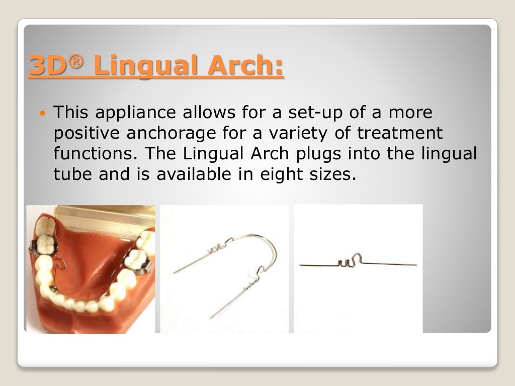 Lingual arch space maintainer