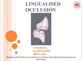 LINGUALISED
OCCLUSION
Presented by:
Dr. Aarti Kochhar
MDS 1st year
Department of Prosthodontics Including Crown & Bridge, Maxillofacial Prosthodontics & Oral
Implantology
 
