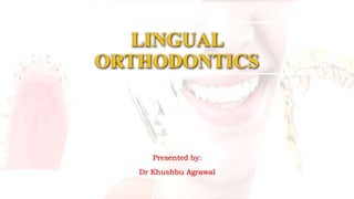 LINGUAL
ORTHODONTICS
Presented by:
Dr Khushbu Agrawal
 
