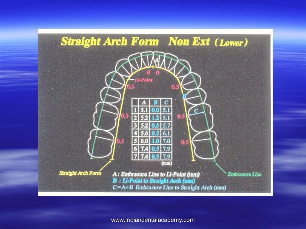 Lingual orthodontics /certified fixed orthodontic courses by Indian