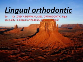 Lingual orthodontic
By Dr .ZAID. AlDEWACHI, MSC, ORTHODONTIC, high
speciality in lingual orthodontic &micro implant
 