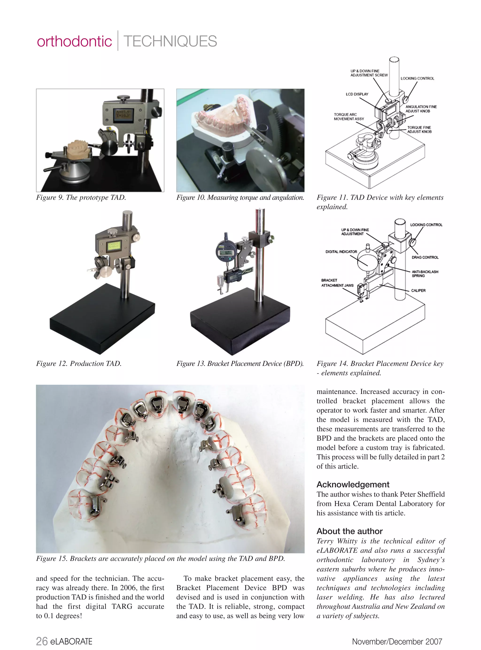 orthodontic | TECHNIQUES




Figure 9. The prototype TAD.                 Figure 10. Measuring torque and angulation.   Figure 11. TAD Device with key elements
                                                                                           explained.




Figure 12. Production TAD.                   Figure 13. Bracket Placement Device (BPD).    Figure 14. Bracket Placement Device key
                                                                                           - elements explained.

                                                                                           maintenance. Increased accuracy in con-
                                                                                           trolled bracket placement allows the
                                                                                           operator to work faster and smarter. After
                                                                                           the model is measured with the TAD,
                                                                                           these measurements are transferred to the
                                                                                           BPD and the brackets are placed onto the
                                                                                           model before a custom tray is fabricated.
                                                                                           This process will be fully detailed in part 2
                                                                                           of this article.

                                                                                           Acknowledgement
                                                                                           The author wishes to thank Peter Sheffield
                                                                                           from Hexa Ceram Dental Laboratory for
                                                                                           his assistance with tis article.

                                                                                           About the author
                                                                                           Terry Whitty is the technical editor of
                                                                                           eLABORATE and also runs a successful
Figure 15. Brackets are accurately placed on the model using the TAD and BPD.              orthodontic laboratory in Sydney’s
                                                                                           eastern suburbs where he produces inno-
and speed for the technician. The accu-        To make bracket placement easy, the         vative appliances using the latest
racy was already there. In 2006, the first   Bracket Placement Device BPD was              techniques and technologies including
production TAD is finished and the world     devised and is used in conjunction with       laser welding. He has also lectured
had the first digital TARG accurate          the TAD. It is reliable, strong, compact      throughout Australia and New Zealand on
to 0.1 degrees!                              and easy to use, as well as being very low    a variety of subjects.


26 eLABORATE                                                                                           November/December 2007
 