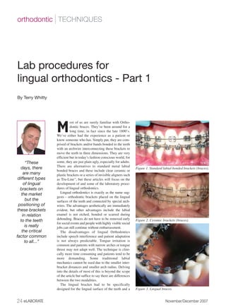 orthodontic | TECHNIQUES




Lab procedures for
lingual orthodontics - Part 1
By Terry Whitty




                              ost of us are surely familiar with Ortho-

                    M         dontic braces. They’ve been around for a
                              long time, in fact since the late 1800’s.
                    We’ve either had the experience as a patient or
                    know someone who has. Simply put, they are com-
                    prised of brackets and/or bands bonded to the teeth
                    with an archwire interconnecting these brackets to
                    move the teeth in three dimensions. They are very
                    efficient but in today’s fashion conscious world, for
       “These       some, they are just plain ugly, especially for adults.
                    There are alternatives to standard metal labial
   days, there                                                                Figure 1. Standard labial-bonded brackets (braces).
                    bonded braces and these include clear ceramic or
      are many      plastic brackets or a series of invisible aligners such
 different types    as Tru-Line™, but these articles will focus on the
      of lingual    development of and some of the laboratory proce-
   brackets on      dures of lingual orthodontics.
                       Lingual orthodontics is exactly as the name sug-
    the market
                    gests - orthodontic brackets placed on the lingual
       but the      surfaces of the teeth and connected by special arch-
  positioning of    wires. The advantages aesthetically are immediately
 these brackets     evident, but other advantages include the labial
     in relation    enamel is not etched, bonded or scarred during
                    debonding. Braces do not have to be removed early
   to the teeth                                                               Figure 2. Ceramic brackets (braces).
                    for social events and people with highly visible social
       is really    jobs can still continue without embarrassment.
    the critical       The disadvantages of lingual Orthodontics
factor common       include speech interference and patient adaptation
       to all...”   is not always predictable. Tongue irritation is
                    common and patients with narrow arches or tongue
                    thrust may not adapt well. The technique is clini-
                    cally more time consuming and patients tend to be
                    more demanding. Some traditional labial
                    mechanics cannot be used due to the smaller inter-
                    bracket distances and smaller arch radius. Delving
                    into the details of most of this is beyond the scope
                    of the article but suffice to say there are differences
                    between the two modalities.
                       The lingual bracket had to be specifically
                    designed for the lingual surface of the teeth and a       Figure 3. Lingual braces.


24 eLABORATE                                                                                      November/December 2007
 