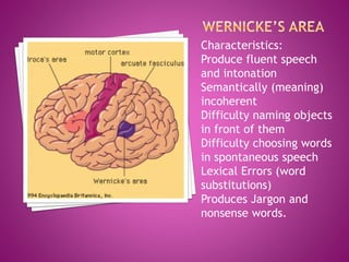 Characteristics:
Produce fluent speech
and intonation
Semantically (meaning)
incoherent
Difficulty naming objects
in front of them
Difficulty choosing words
in spontaneous speech
Lexical Errors (word
substitutions)
Produces Jargon and
nonsense words.
 