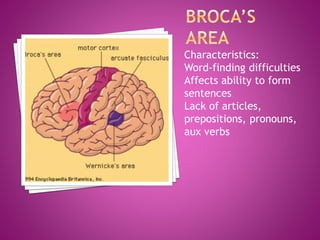 Characteristics:
Word-finding difficulties
Affects ability to form
sentences
Lack of articles,
prepositions, pronouns,
aux verbs
 