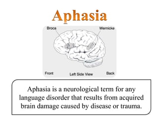 BRAIN AND LANGUAGE 4
Aphasia is a neurological term for any
language disorder that results from acquired
brain damage caused by disease or trauma.
 