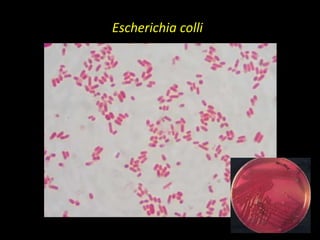 Escherichia colli
 