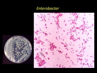 Enterobacter
 