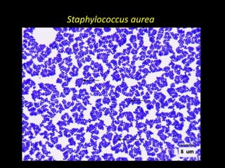 Staphylococcus aurea
 