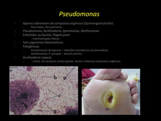 Pseudomonas
- Apenas sobrevivem de compostos orgânicos (Quimiorganicotrofia)
- Peso baixo, não polímeros
- Pseudomonas, Burkholderia, Zymomonas, Xanthosomas
- Esferóides ou bacilos, flagelo polar
- movimentação intensa
- Sem pigmentos fotosintéticos
- Patogênicas
- Pseudomonas aeruginosa – infecções (resistência via plasmídeos)
- Xanthomonas, P. syringae – atacam plantas,
- Burkholderia cepacia
- - cresce em acúcares, ácidos graxos, alcool, e diversos compostos orgânicos
 