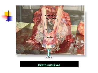 Pinças
1º Médios
2º Médios
Cantos ou
Extremos
 