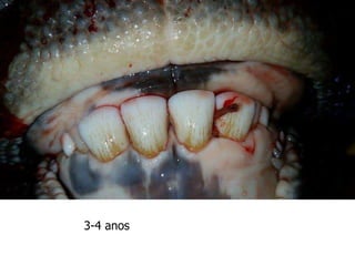 3-4 anos
 