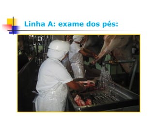 Linha A: exame dos pés:
 