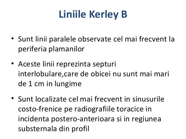 Linii kerley