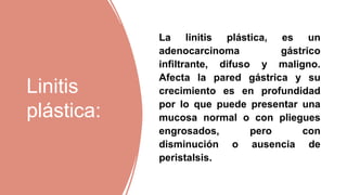 Linitis plastica PPT