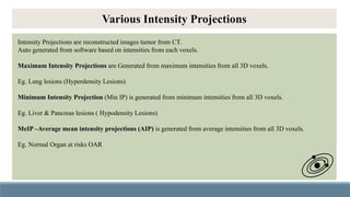 Significance of Robust Motion Management & Approaches In Radiotherapy ...