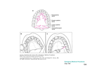 104
Emergency Medicine Procedures
Chp 154
 
