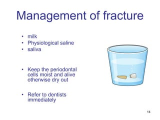 14
Management of fracture
• milk
• Physiological saline
• saliva
• Keep the periodontal
cells moist and alive
otherwise dry out
• Refer to dentists
immediately
 