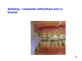 38
Splinting – composite with/without wire or
bracket
 