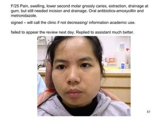 51
F/25 Pain, swelling, lower second molar grossly caries, extraction, drainage at
gum, but still needed incision and drainage. Oral antibiotics-amoxycillin and
metronidazole.
signed – will call the clinic if not decreasing/ information academic use.
failed to appear the review next day. Replied to assistant much better.
 
