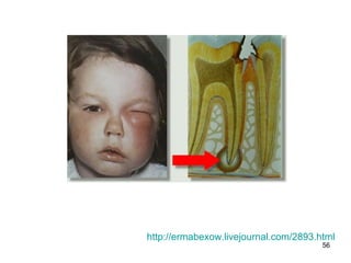 56
http://ermabexow.livejournal.com/2893.html
 