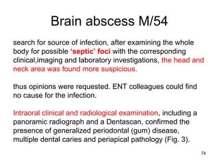 74
Brain abscess M/54
search for source of infection, after examining the whole
body for possible ‘septic’ foci with the corresponding
clinical,imaging and laboratory investigations, the head and
neck area was found more suspicious.
thus opinions were requested. ENT colleagues could find
no cause for the infection.
Intraoral clinical and radiological examination, including a
panoramic radiograph and a Dentascan, confirmed the
presence of generalized periodontal (gum) disease,
multiple dental caries and periapical pathology (Fig. 3).
 