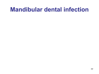 77
Mandibular dental infection
 