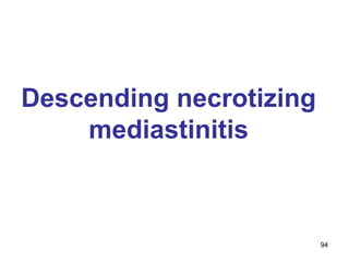 94
Descending necrotizing
mediastinitis
 