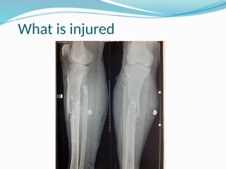 What is injured