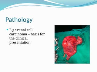 Pathology
E.g : renal cell
carcinoma – basis for
the clinical
presentation