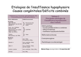 Etiologies de l’insuffisance hypophysaire
 Causes congénitales/Déficits combinés
 