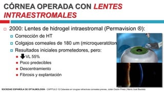 CÓRNEA OPERADA CON LENTES
INTRAESTROMALES
 2000: Lentes de hidrogel intraestromal (Permavision ®):
 Corrección de HT
 Colgajos corneales de 180 um (microqueratótomo)
 Resultados iniciales prometedores, pero:
 VL 55%
 Poco predecibles
 Descentramiento
 Fibrosis y explantación
SOCIEDAD ESPAÑOLA DE OFTALMOLOGÍA - CAPÍTULO 12 Cataratas en cirugías refractivas corneales previas, Julián Cezón Prieto | María José Bautista
 