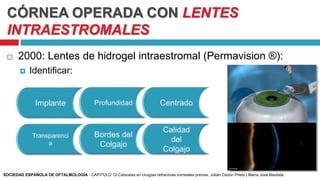 CÓRNEA OPERADA CON LENTES
INTRAESTROMALES
 2000: Lentes de hidrogel intraestromal (Permavision ®):
 Identificar:
SOCIEDAD ESPAÑOLA DE OFTALMOLOGÍA - CAPÍTULO 12 Cataratas en cirugías refractivas corneales previas, Julián Cezón Prieto | María José Bautista
 
