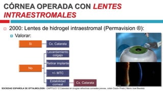 CÓRNEA OPERADA CON LENTES
INTRAESTROMALES
 2000: Lentes de hidrogel intraestromal (Permavision ®):
 Valorar:
SOCIEDAD ESPAÑOLA DE OFTALMOLOGÍA - CAPÍTULO 12 Cataratas en cirugías refractivas corneales previas, Julián Cezón Prieto | María José Bautista
 