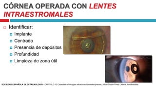 CÓRNEA OPERADA CON LENTES
INTRAESTROMALES
 Identificar:
 Implante
 Centrado
 Presencia de depósitos
 Profundidad
 Limpieza de zona útil
SOCIEDAD ESPAÑOLA DE OFTALMOLOGÍA - CAPÍTULO 12 Cataratas en cirugías refractivas corneales previas, Julián Cezón Prieto | María José Bautista
 
