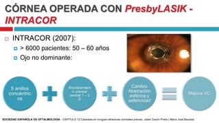 CÓRNEA OPERADA CON PresbyLASIK -
INTRACOR
 INTRACOR (2007):
 > 6000 pacientes: 50 – 60 años
 Ojo no dominante:
SOCIEDAD ESPAÑOLA DE OFTALMOLOGÍA - CAPÍTULO 12 Cataratas en cirugías refractivas corneales previas, Julián Cezón Prieto | María José Bautista
 
