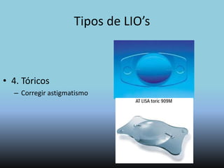 Lentes Intraoculares