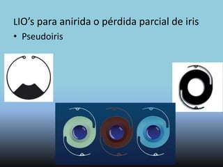 Lentes Intraoculares